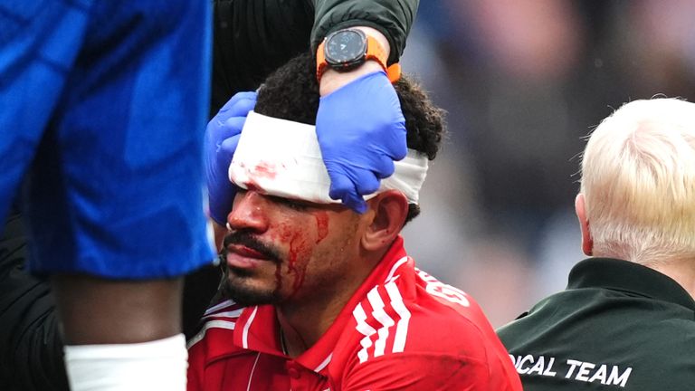 Chelsea 1-3 Nottingham Forest: Awoniyi's brace sink Blues at Stamford Bridge 2 Morgan Gibbs-White sustains head injury after his clash with Chelsea goalie, Robert Sanchez, during the Premier League match at Stamford Bridge on Monday 4 May, 2026